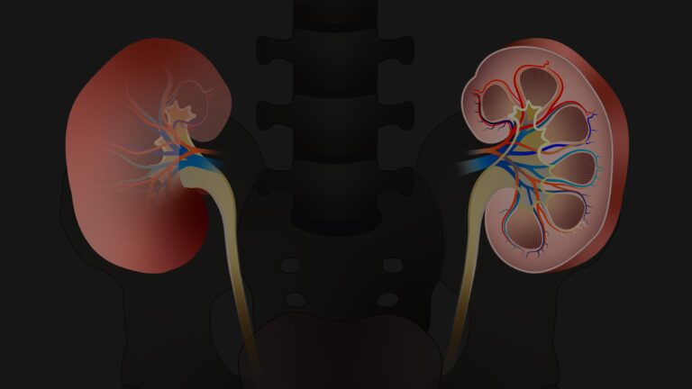 Chronic Kidney Disease & Hypertension